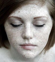 Redheads and freckles