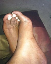 Just remarkable toes