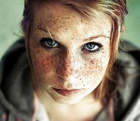 Redheads with Freckles By Antz